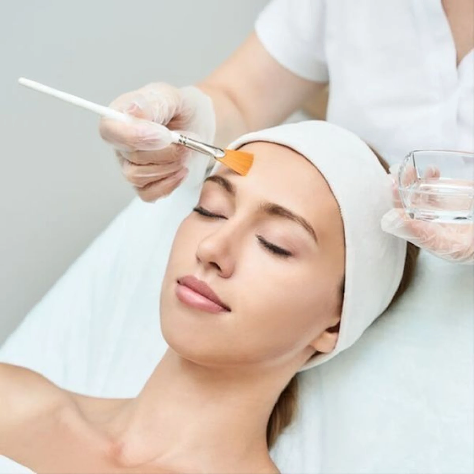 Chemical Peels