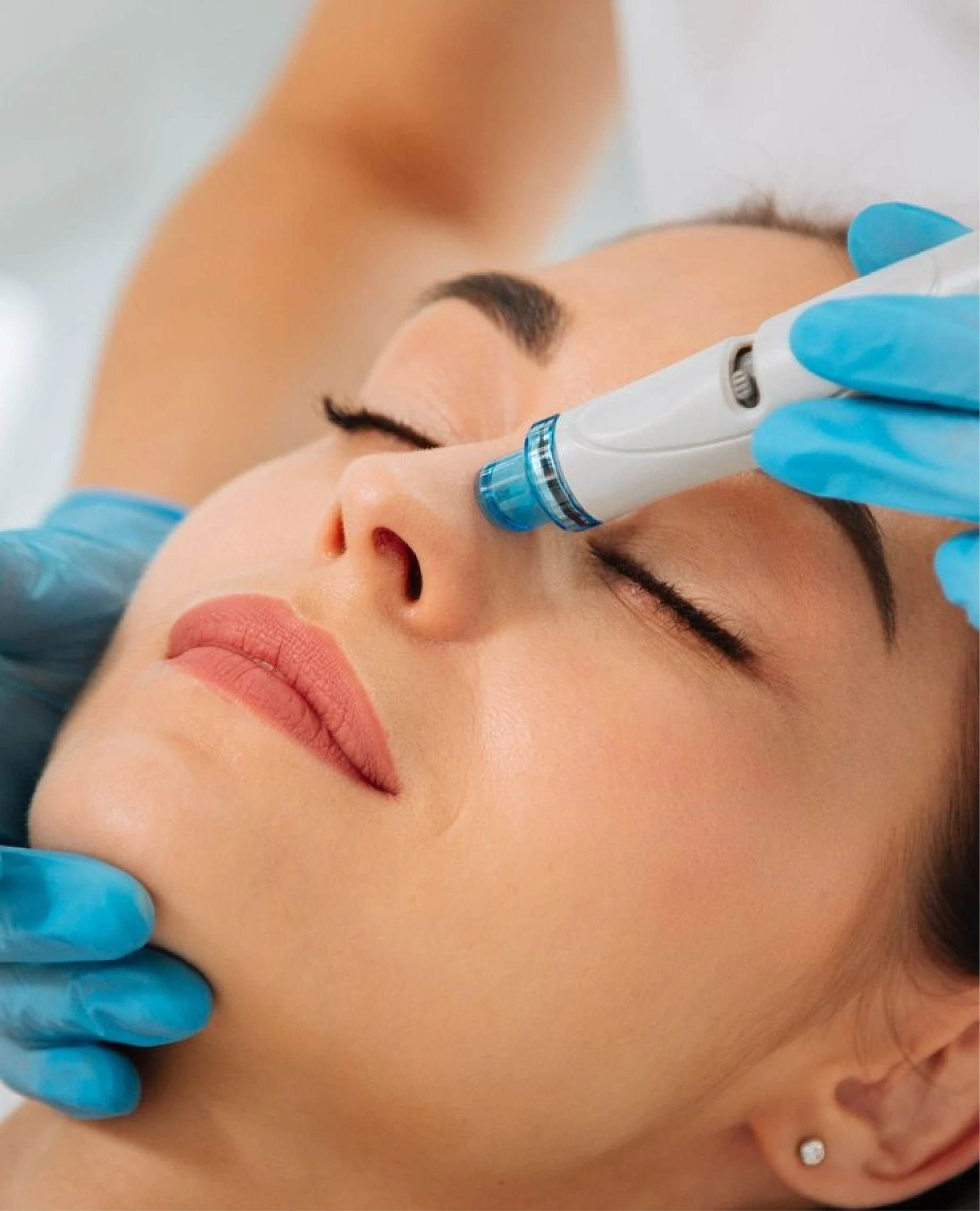 Hydra Facial