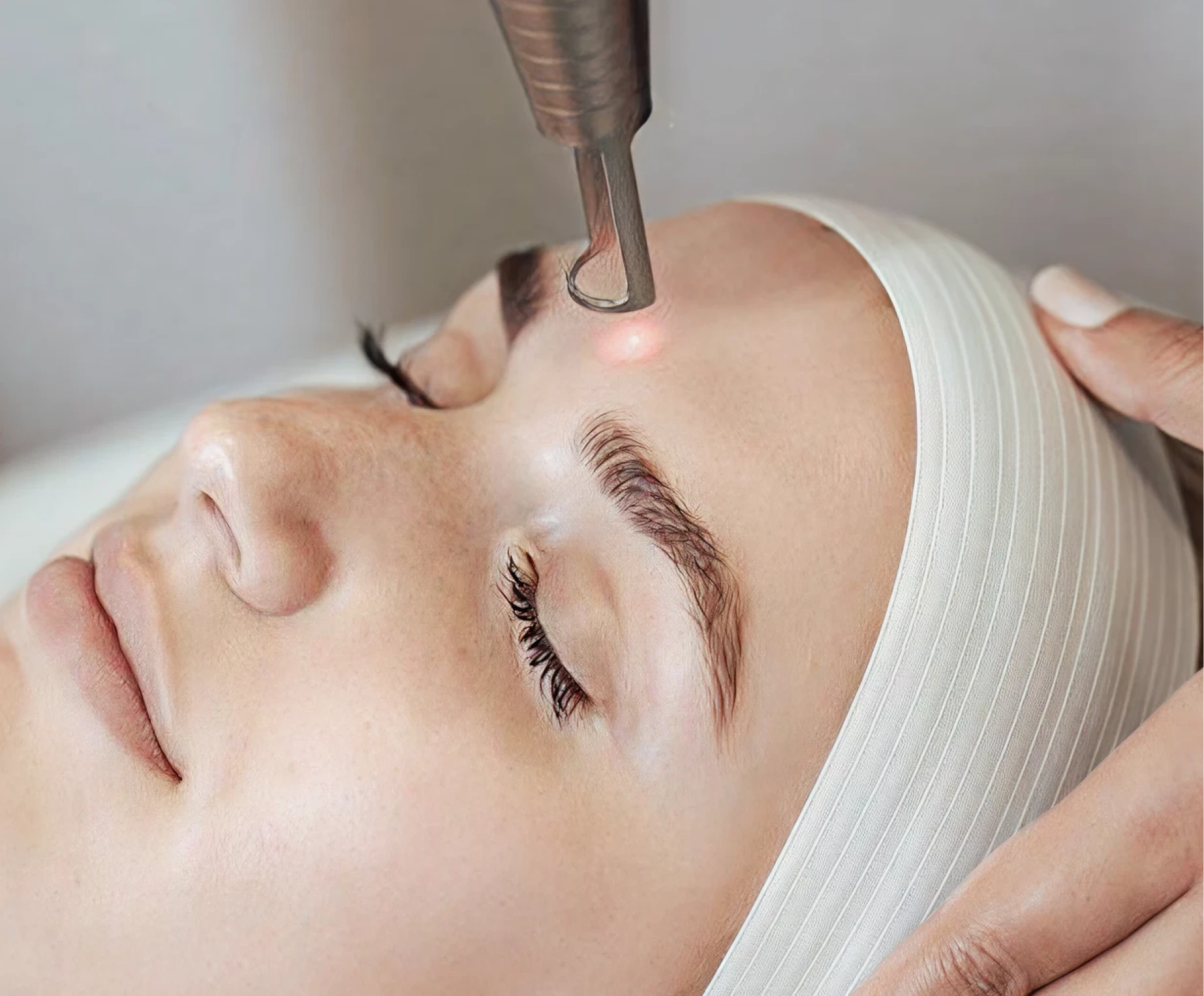 Laser Toning
