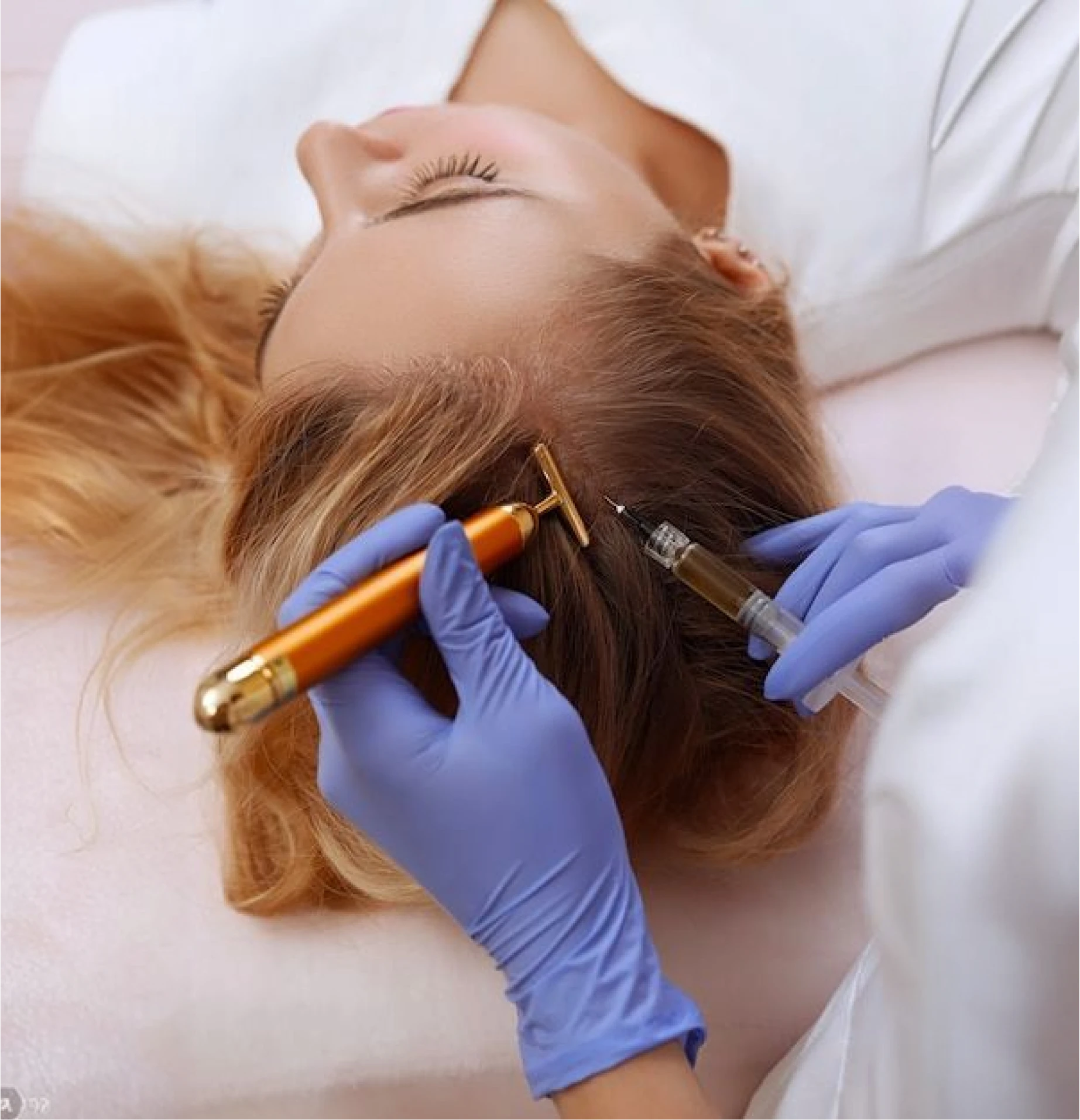 Mesotherapy for Hair