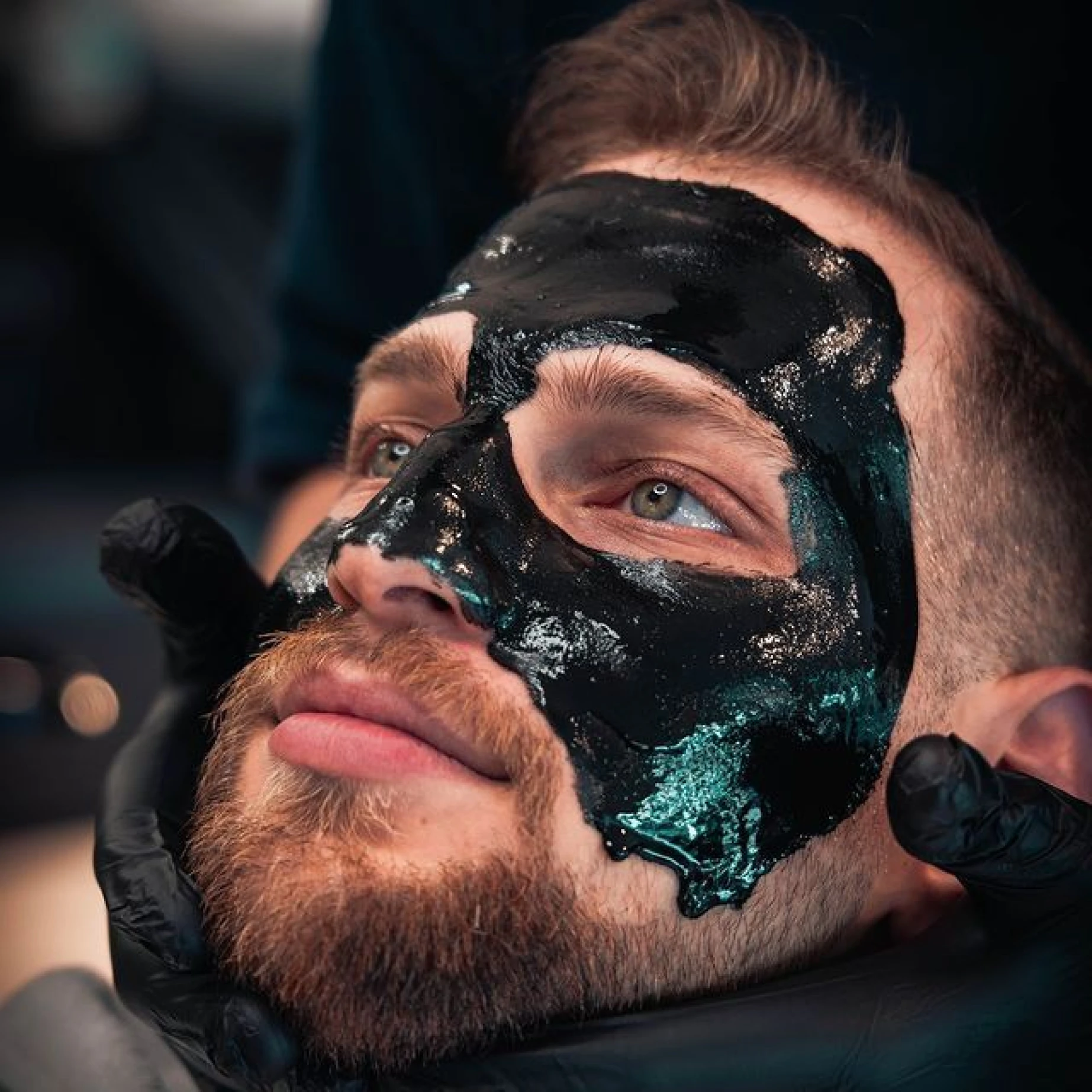Carbon Facial - Sattva Skin Clinic