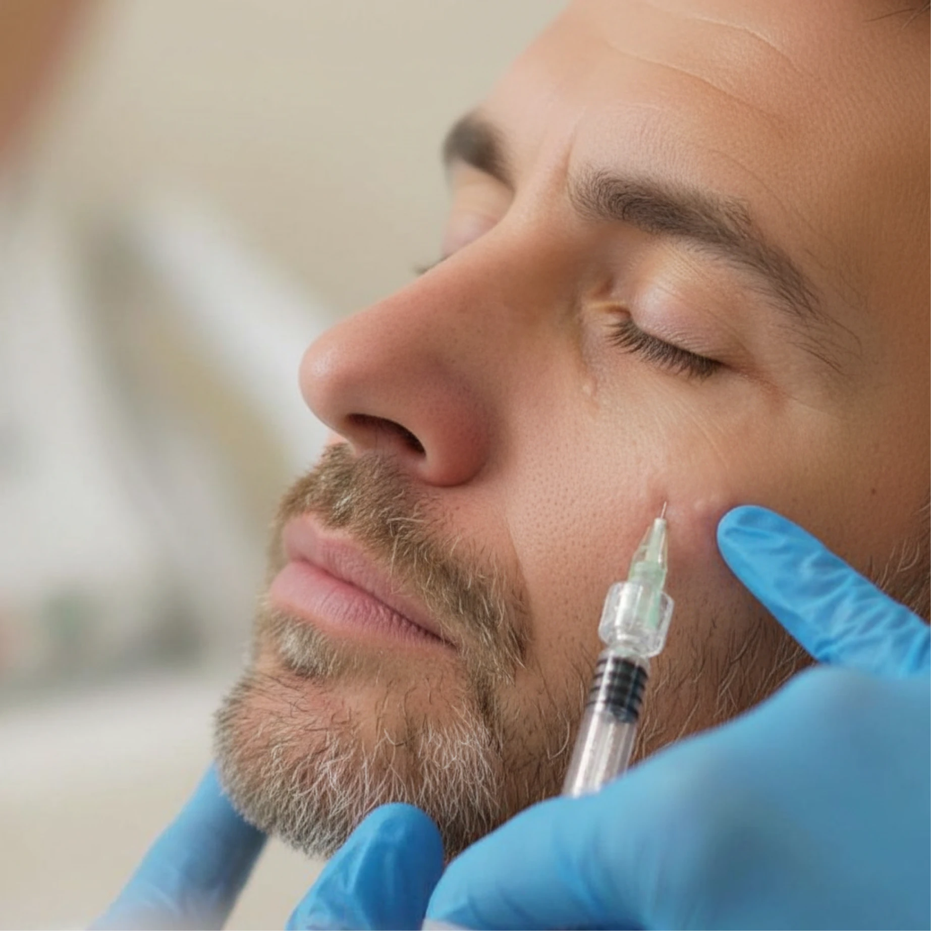 Mesotherapy - Sattva Skin Clinic