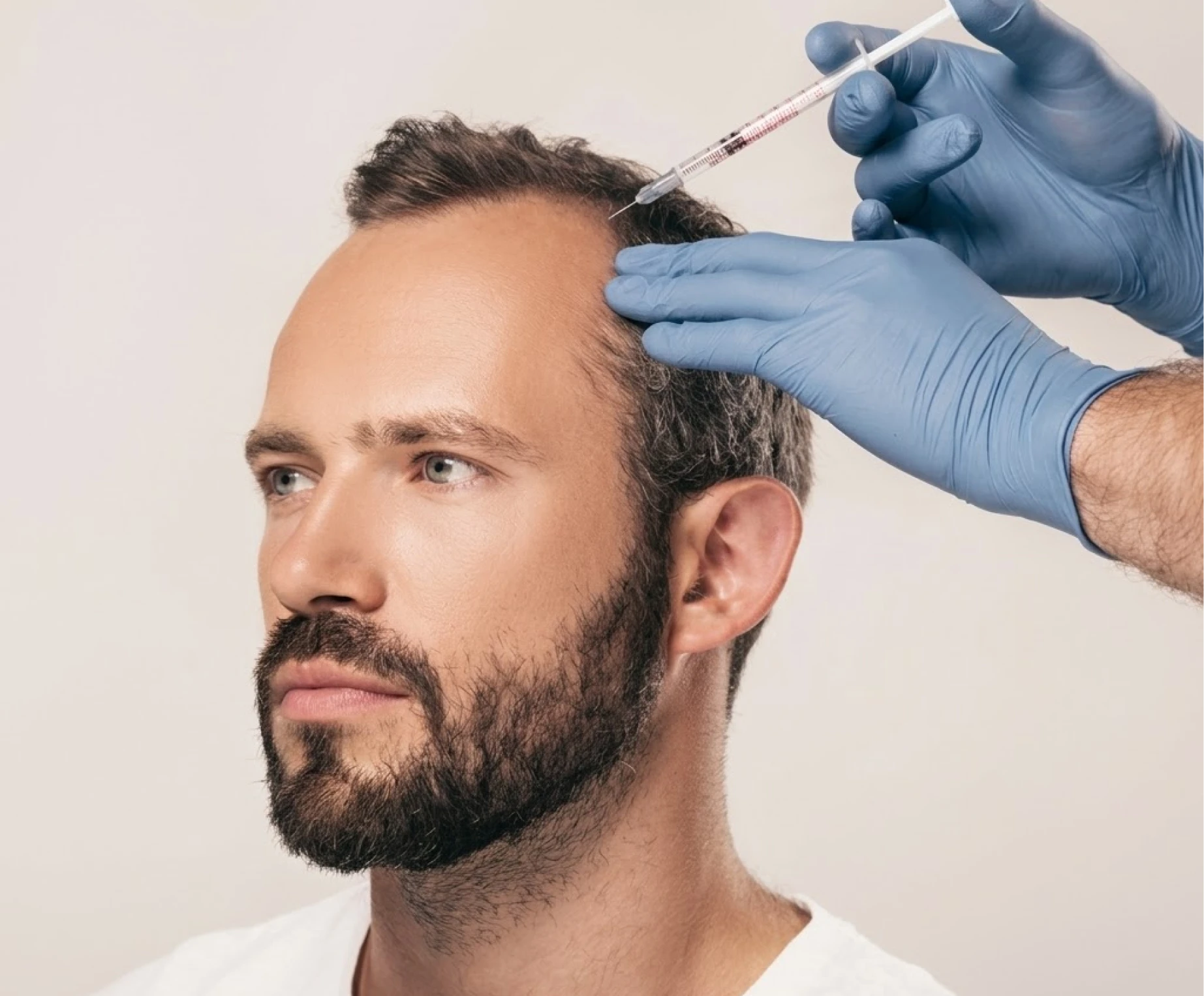 PRP for Hair - Sattva Skin Clinic
