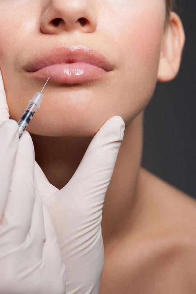 Dermal fillers treatment on lips to restore facial volume