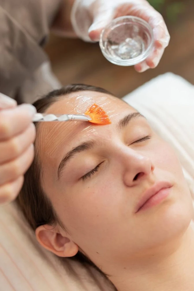 Chemical peels treatment on face for exfoliation and skin renewal
