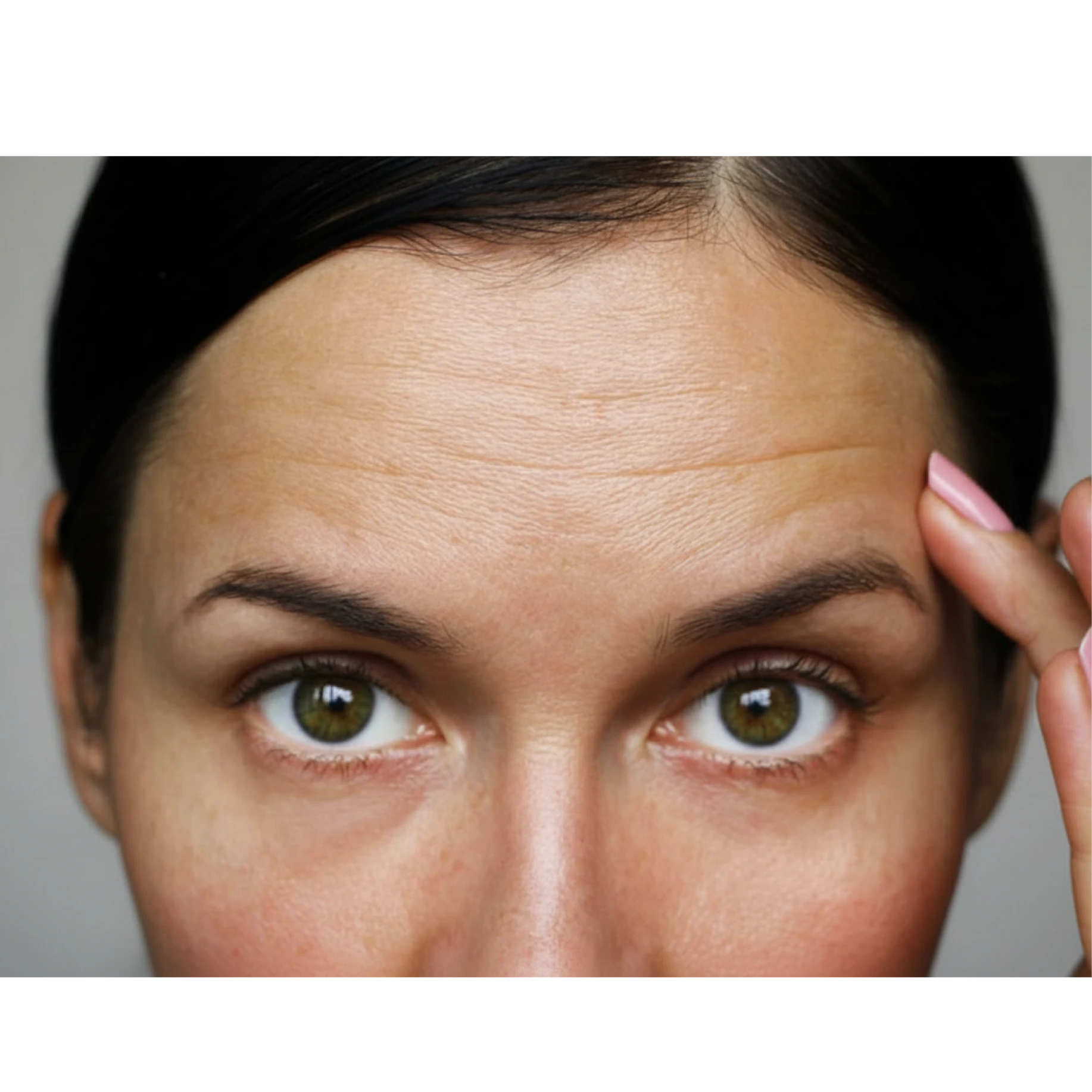 Who Botox is suitable for