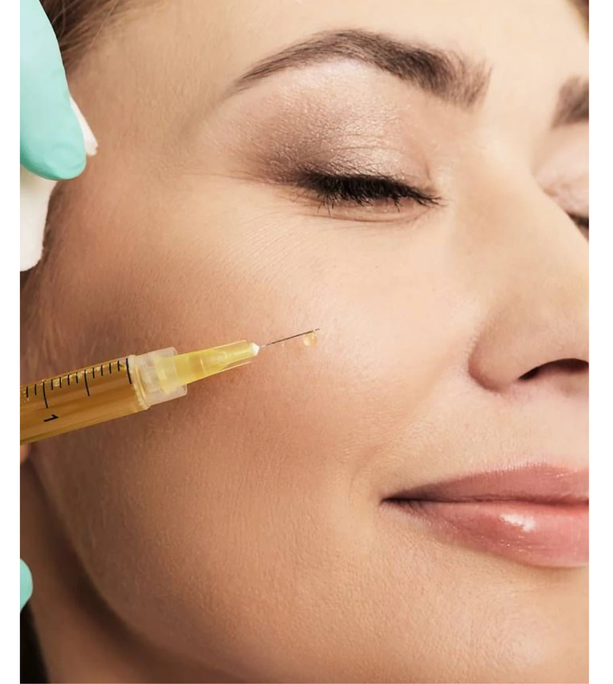 Step 3: Injection
