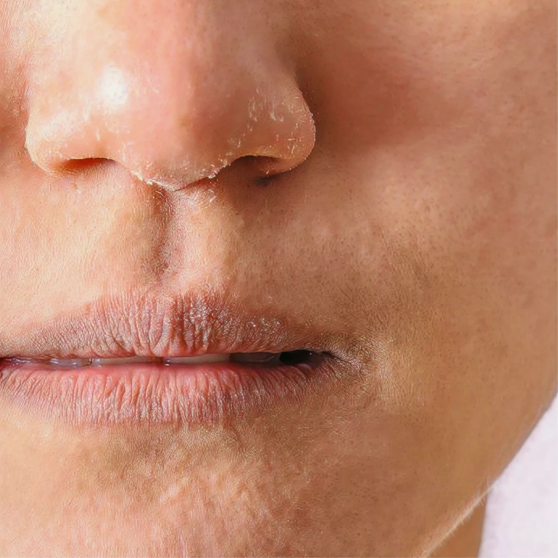 Who Skin Boosters is suitable for