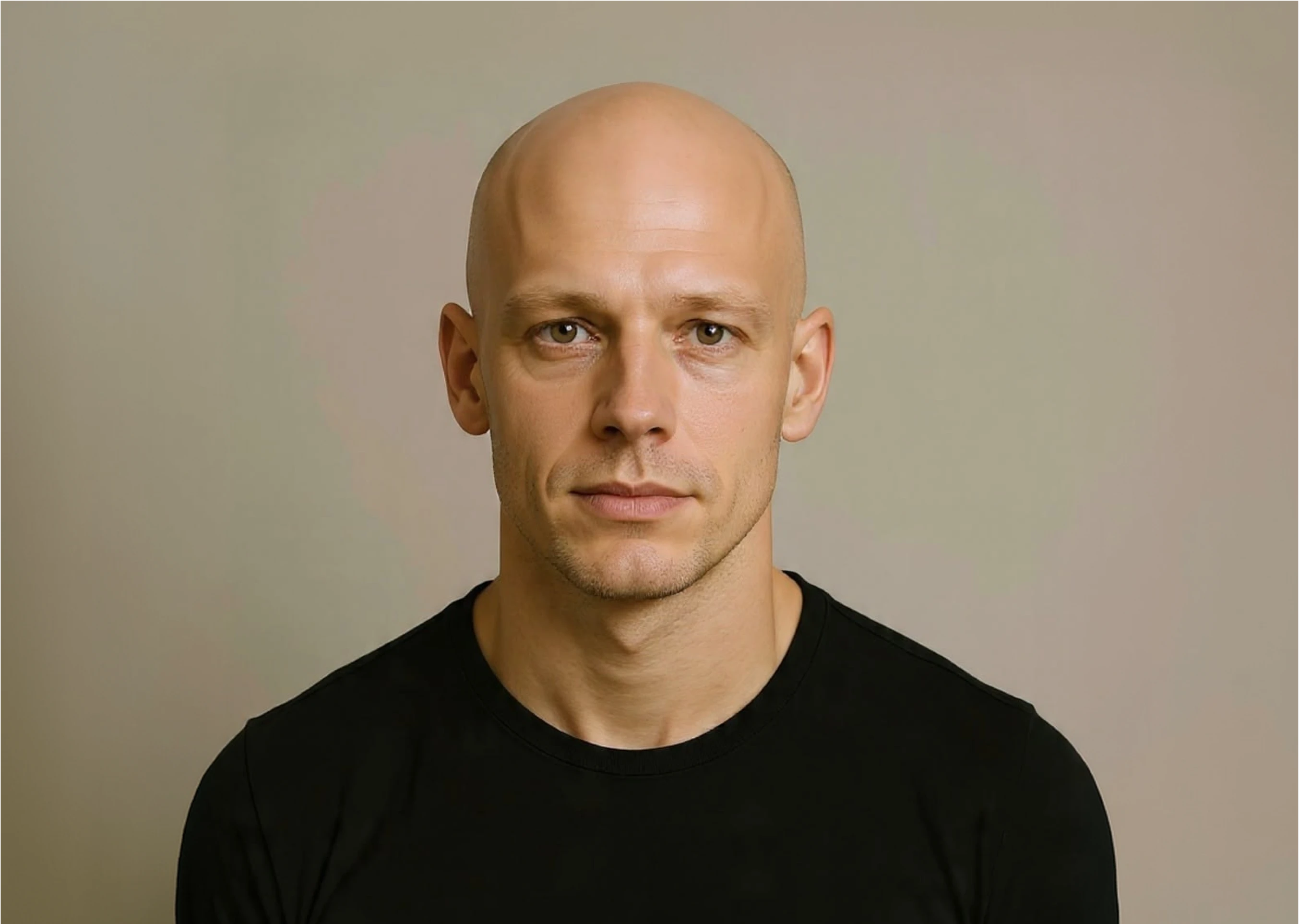 Hair Transplant - when this treatment is not recommended