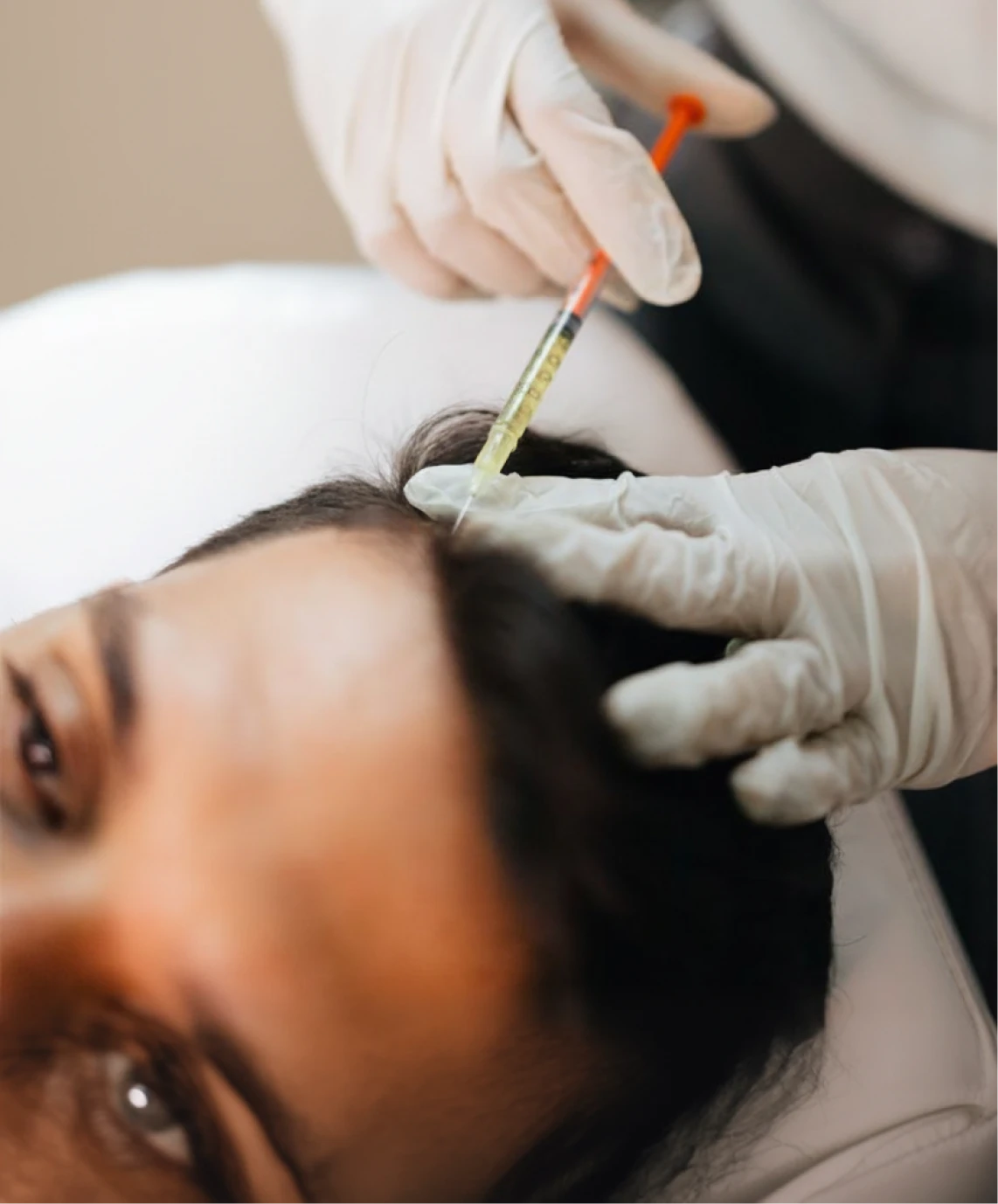 Step 4: Scalp Preparation