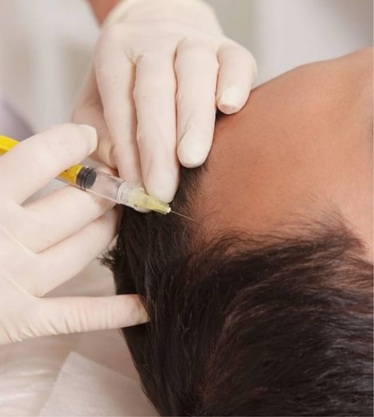 Step 5: PRP Injection