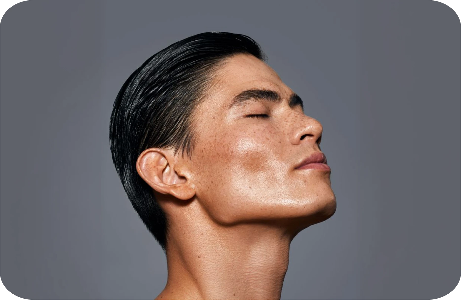 Results after Skin Boosters at Sattva Skin Clinic