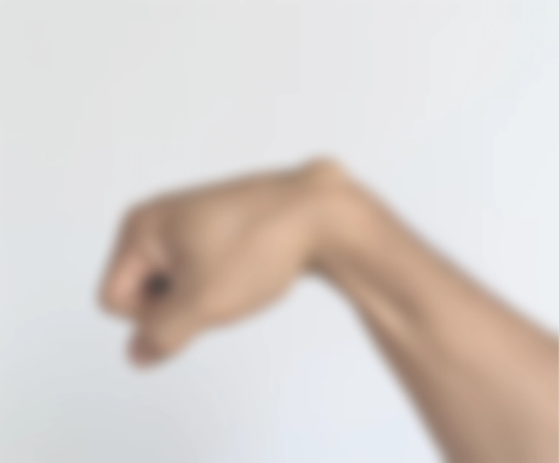 Lipoma Removal - Sattva Skin Clinic