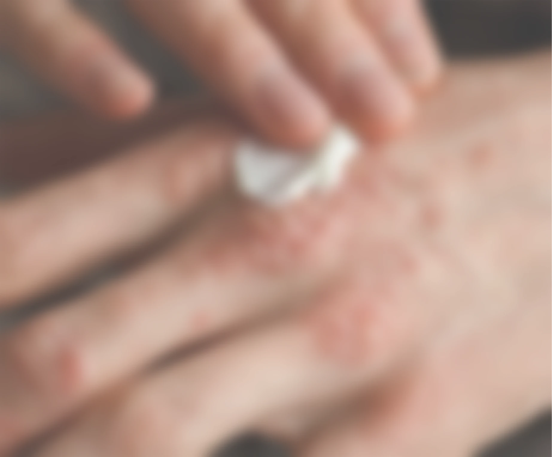 Psoriasis - Sattva Skin Clinic