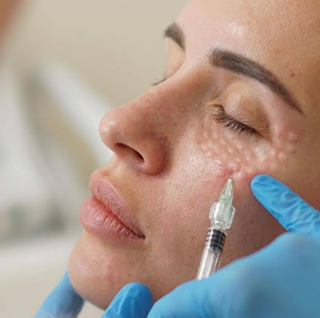 sattva skin clinic with advanced technology - reema kataria - Mesotherapy Image