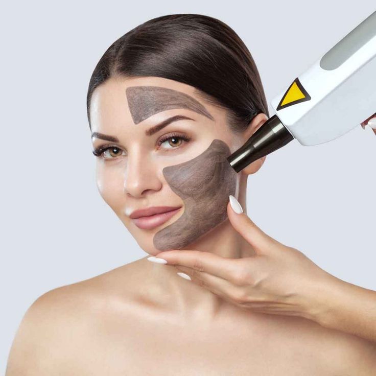 sattva skin clinic with advanced technology - reema kataria - Q SWITCH laser Image